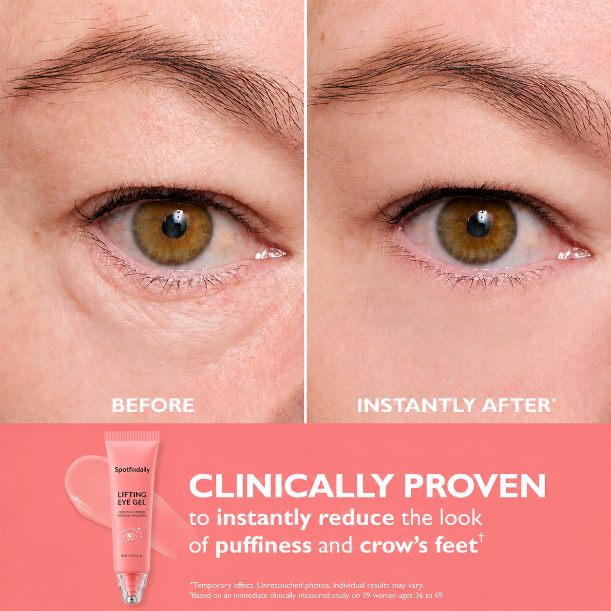 Spotfixdaily Eye Gel Stick
